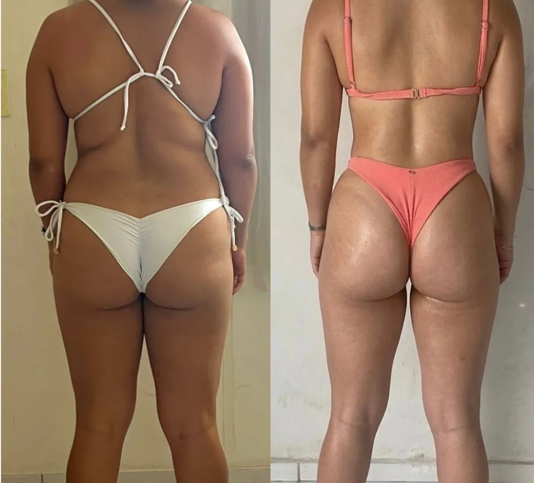 Antes de Depois 
