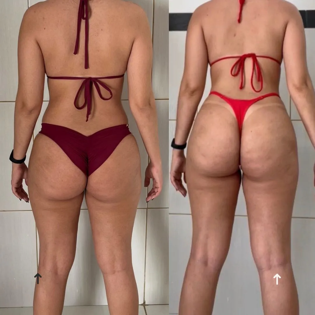 Antes e Depois
