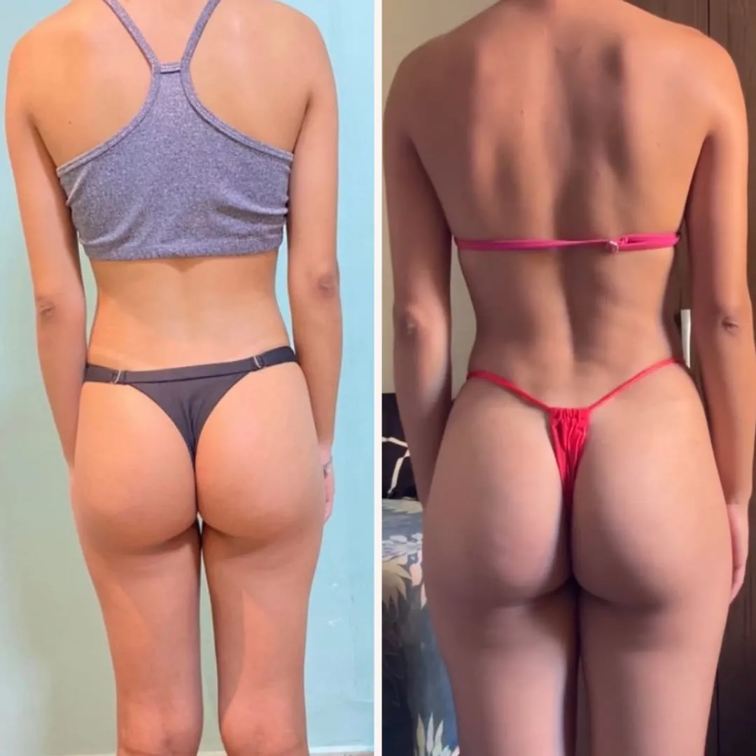 Antes e Depois 