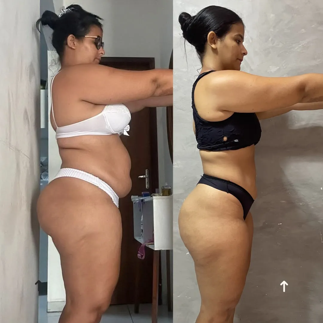 Antes e Depois 